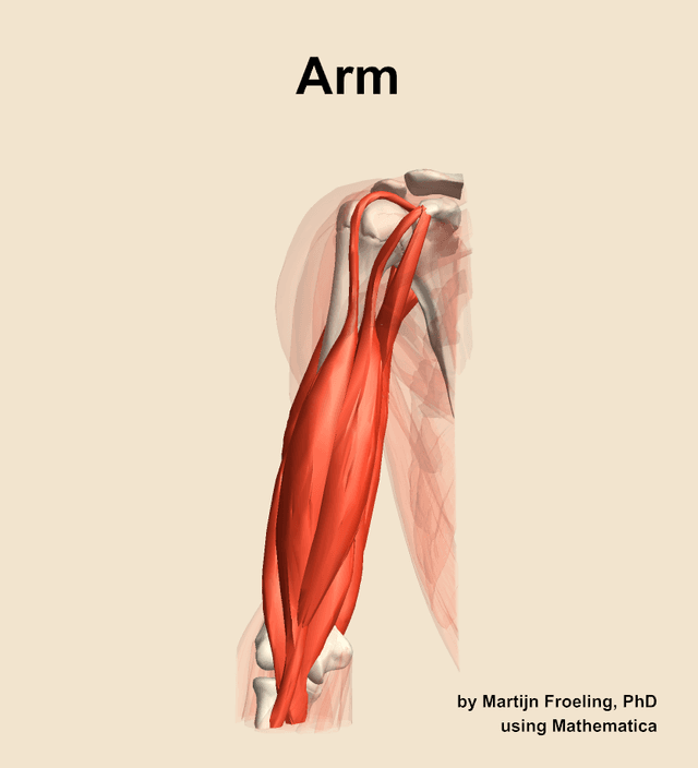 Arm